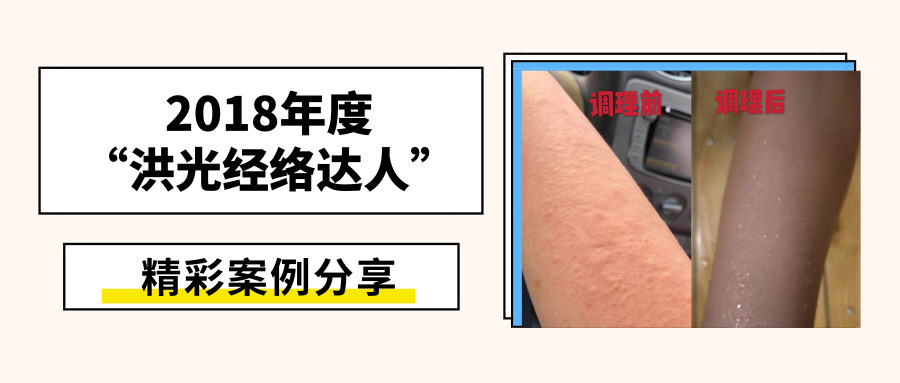 坚持洪光 ，湿疹去无踪